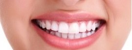 Zahnzusatzversicherung angeratene Behandlung